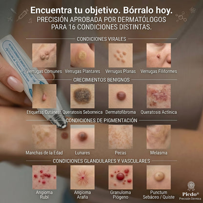 𝐏𝐢𝐜𝐝𝐨® Borrador de Verrugas y Manchas en 7 Días (𝐀𝐩𝐥𝐢𝐜𝐚𝐝𝐨𝐫 𝐫𝐨𝐥𝐥-𝐨𝐧: 𝐬𝐢𝐧 𝐝𝐨𝐥𝐨𝐫 𝐧𝐢 𝐜𝐢𝐜𝐚𝐭𝐫𝐢𝐜𝐞𝐬)